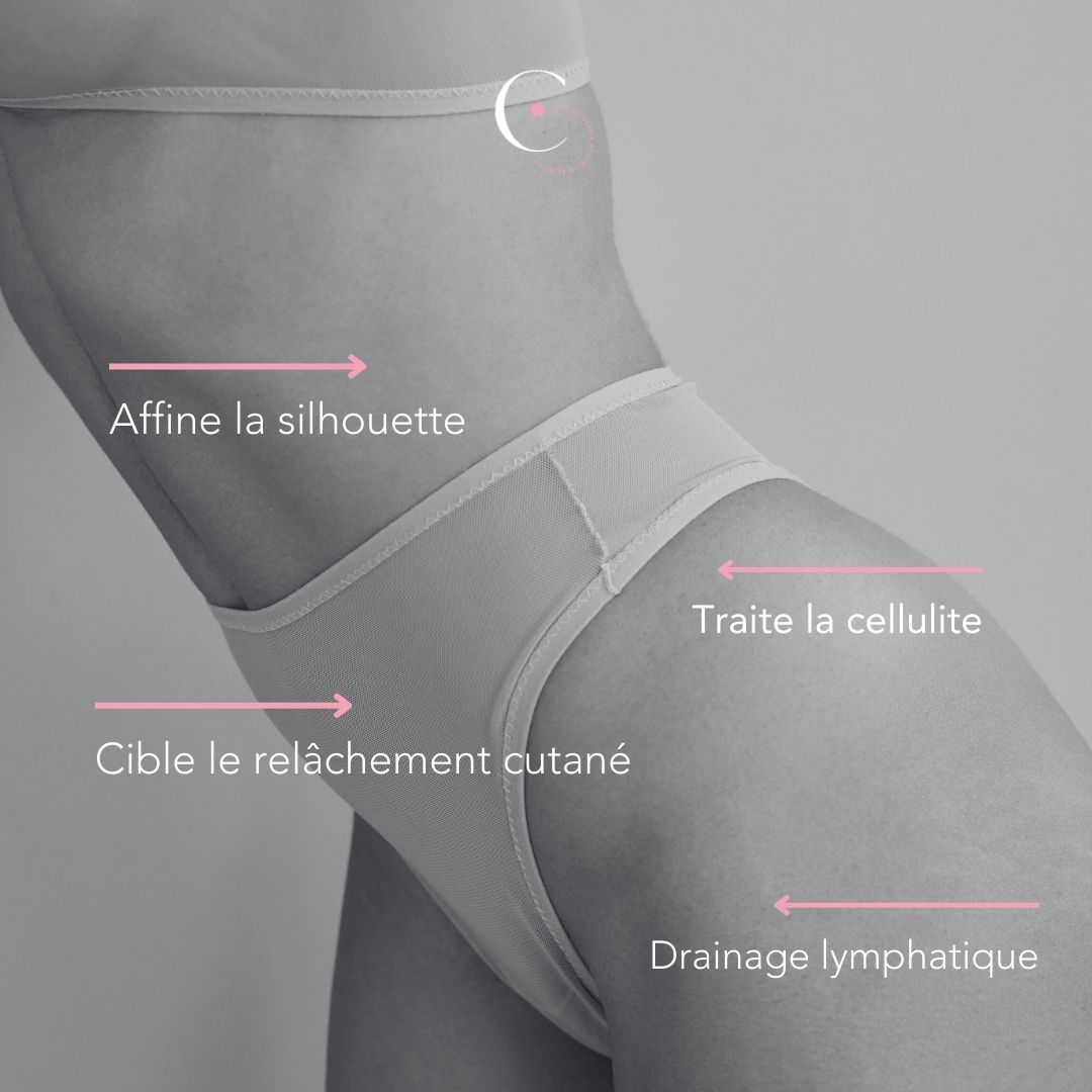 Esthederma - Cellution® — La technologie ultime anti-cellulite de DELEO