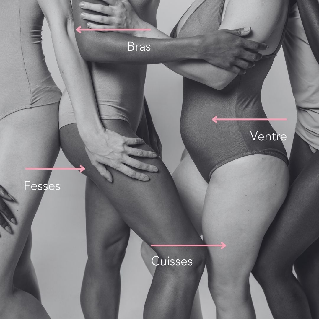 Esthederma - Cellution® — La technologie ultime anti-cellulite de DELEO